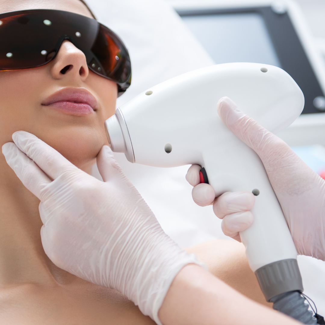 Chin Area Laser Hair Removal